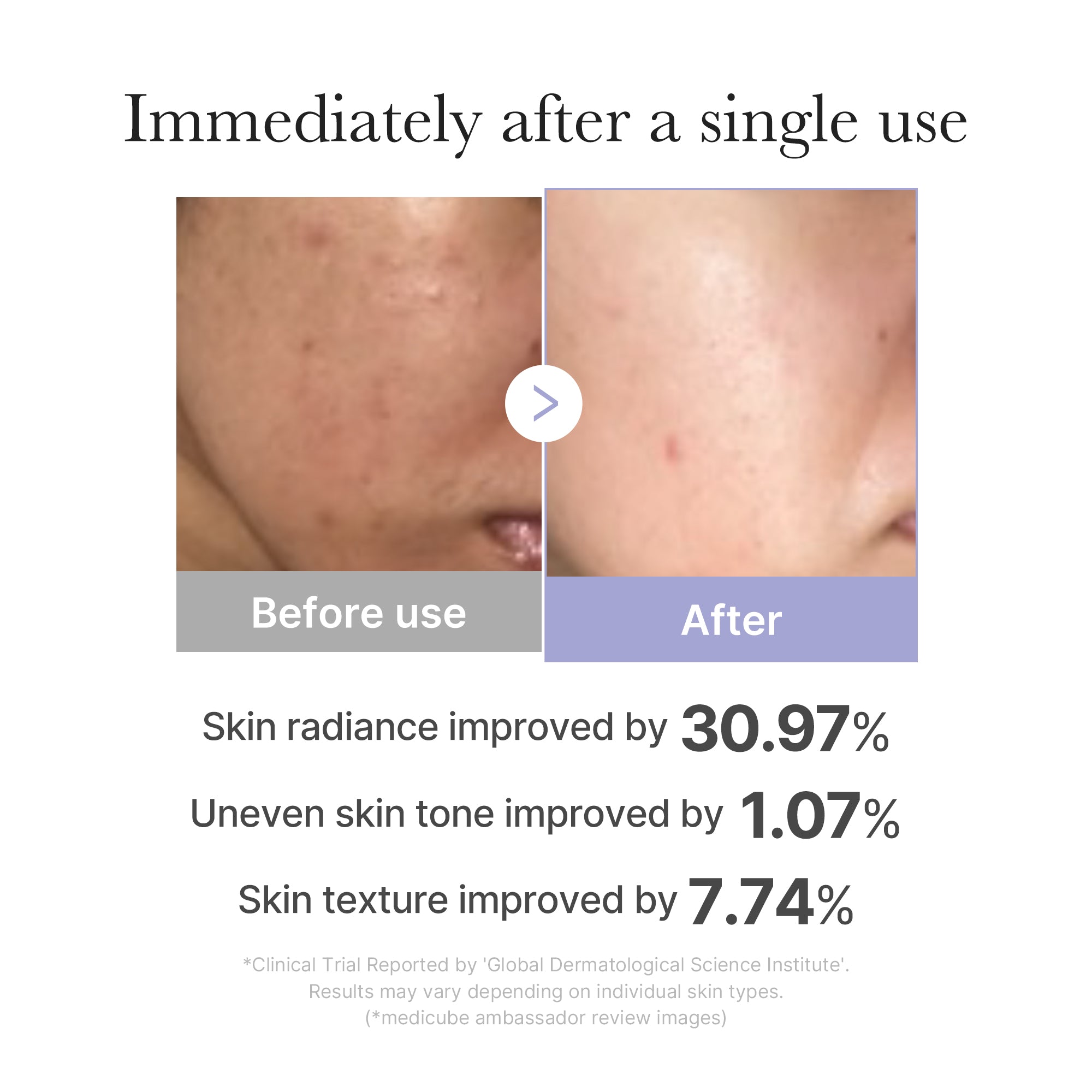 MEDICUBE PDRN Glass Skin Booster Set