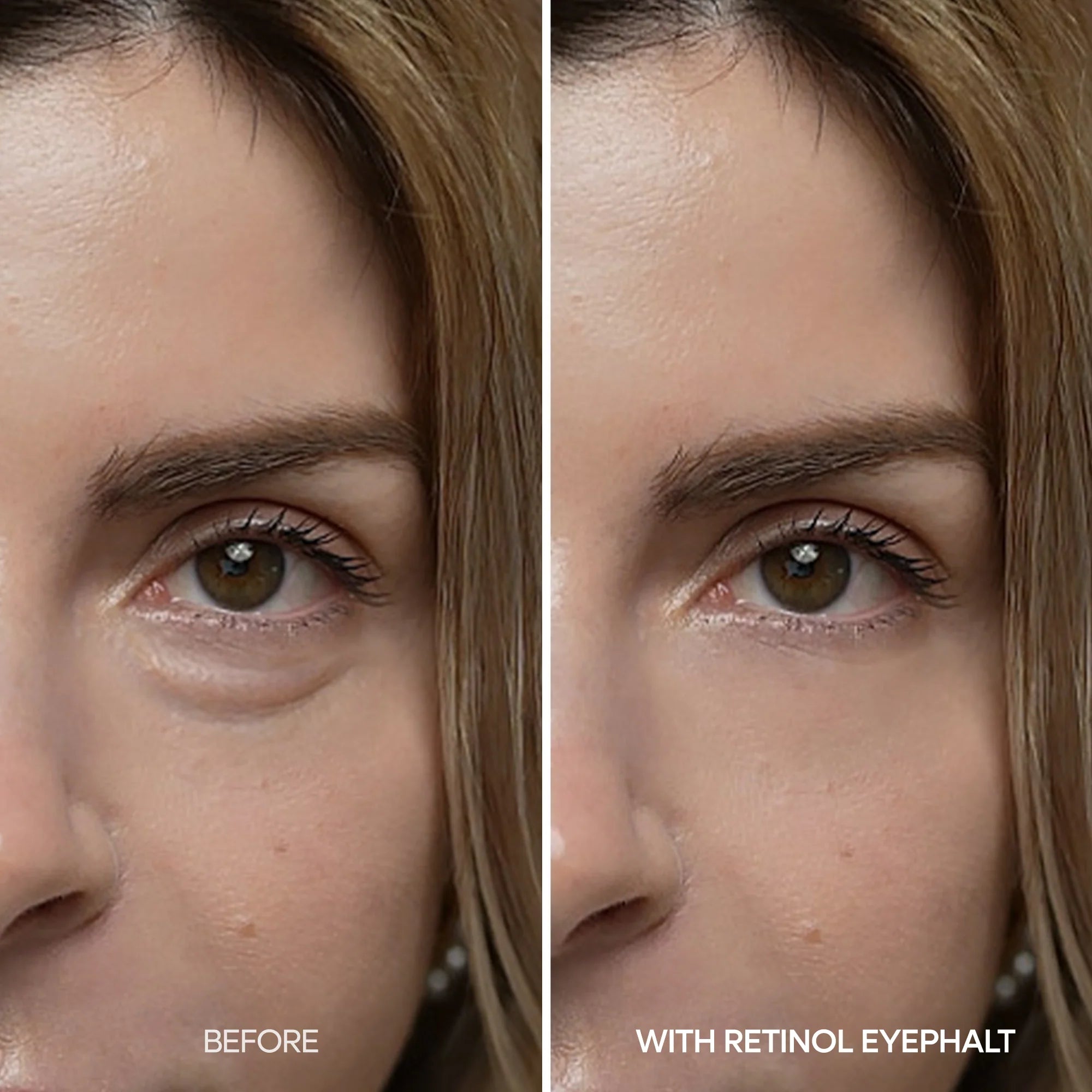 Dr Melaxin Retinol Eyebag Cream 10g