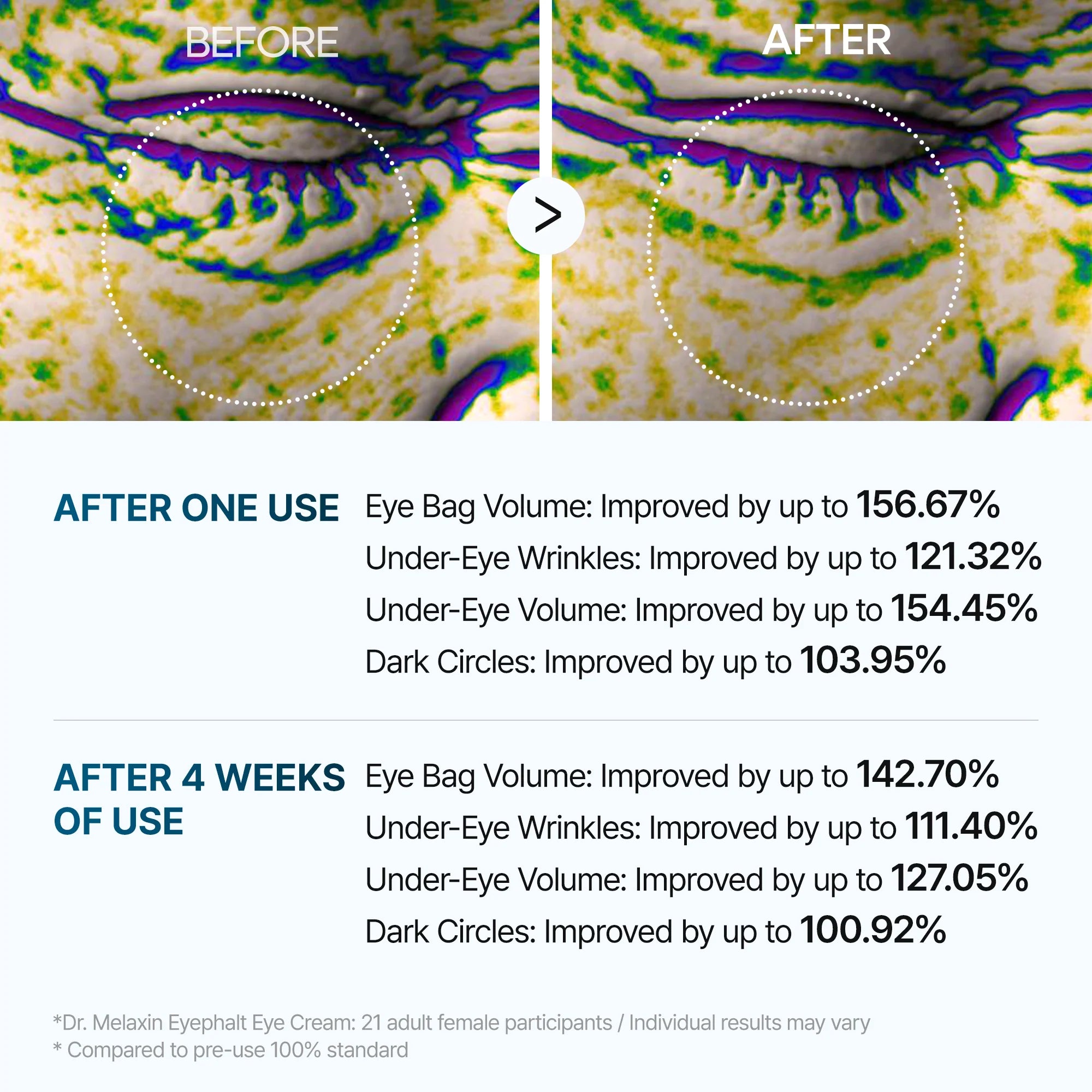 Dr Melaxin Eyephalt Eyebag Cream 10ml