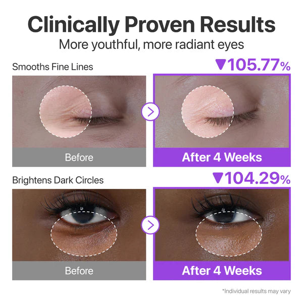 Numbuzin No.9 NAD+ Retinol Volumetox Κρέμα Ματιών 10ml