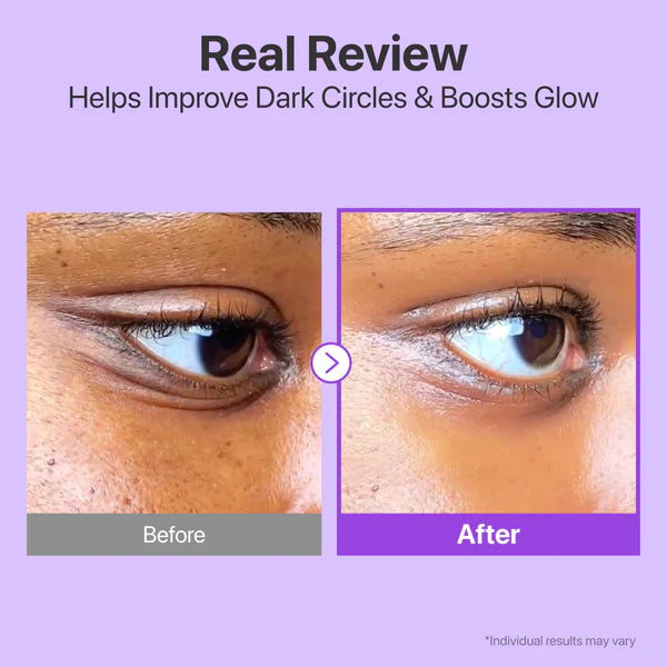 Numbuzin No.9 NAD+ Retinol Volumetox Κρέμα Ματιών 10ml