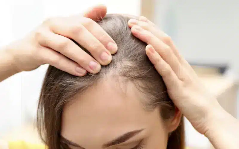 MEDICEUTICALS Advanced Hair Restoration Kit for Women