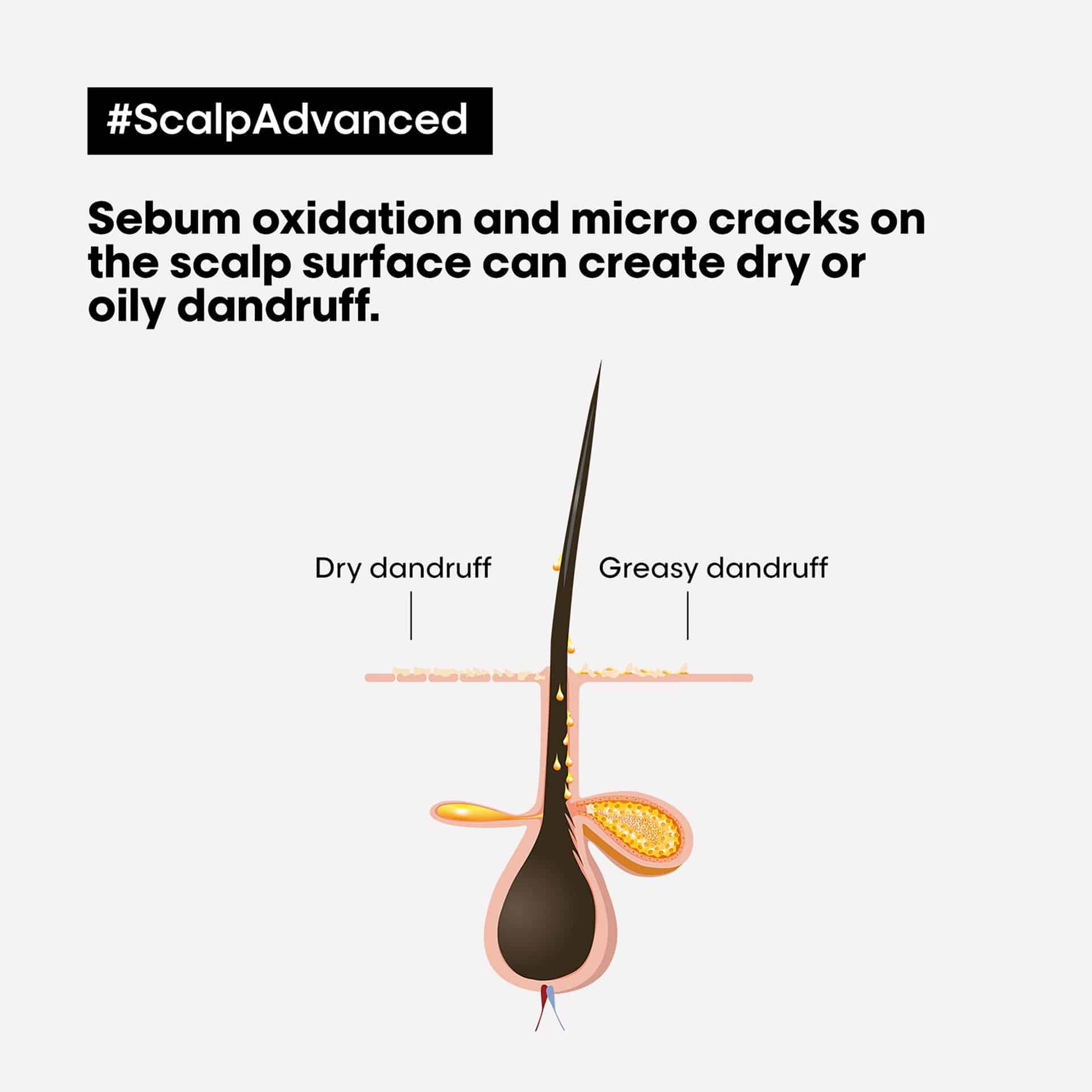 LOréal Scalp Advanced Shampoo for Anti-Dandruff 300ml