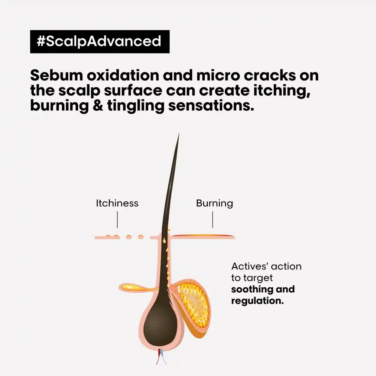 LOréal Scalp Advanced Intense soother Treatment for Anti-discomfort 200ml