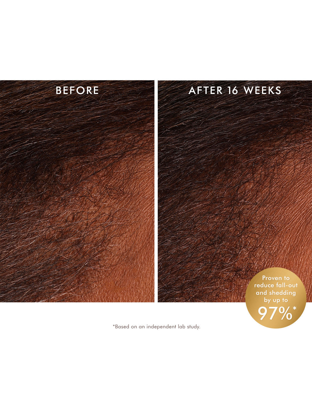 MOROCCANOIL Complete Scalp Reset Set