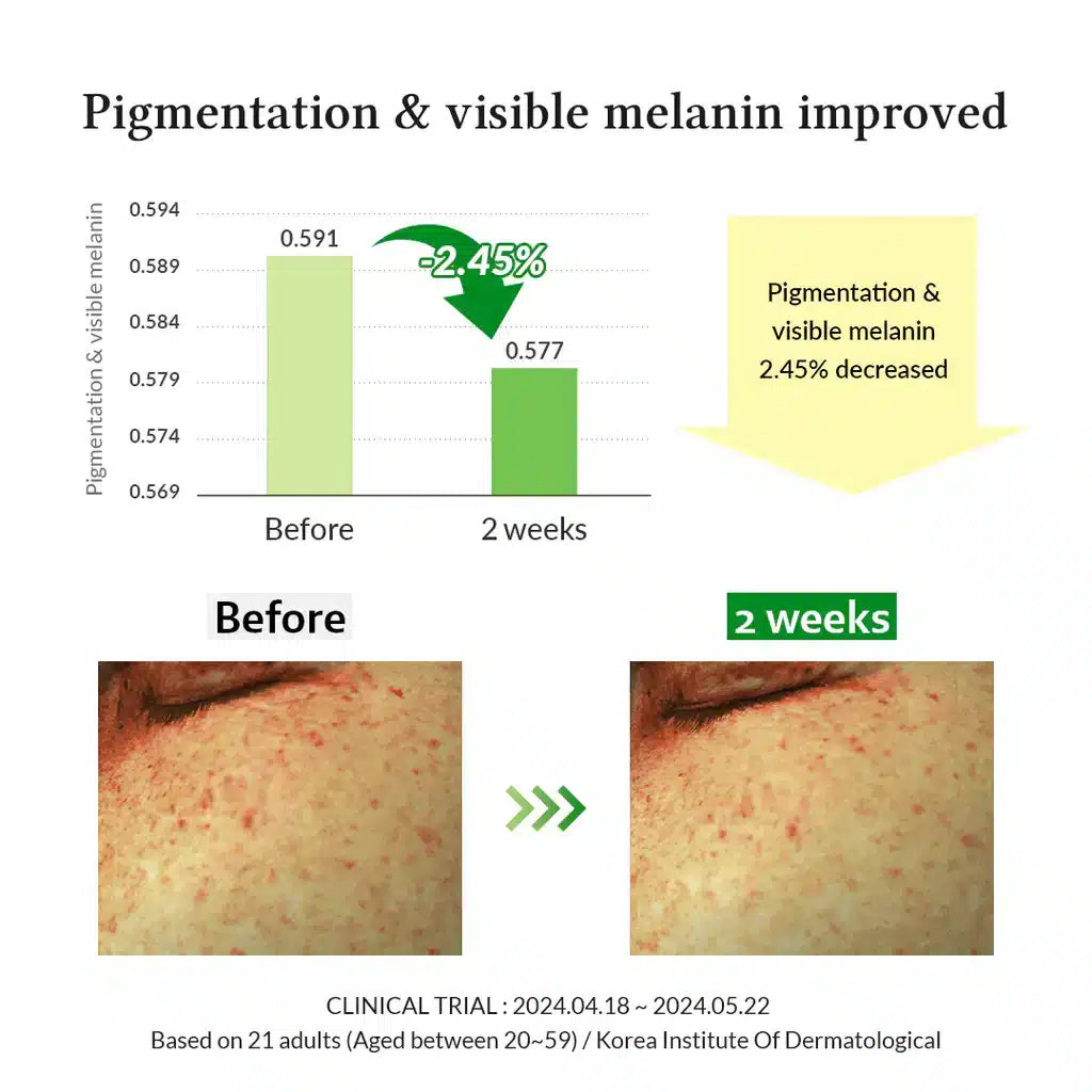Dr Althea Gentle Vitamin C Serum 30ml