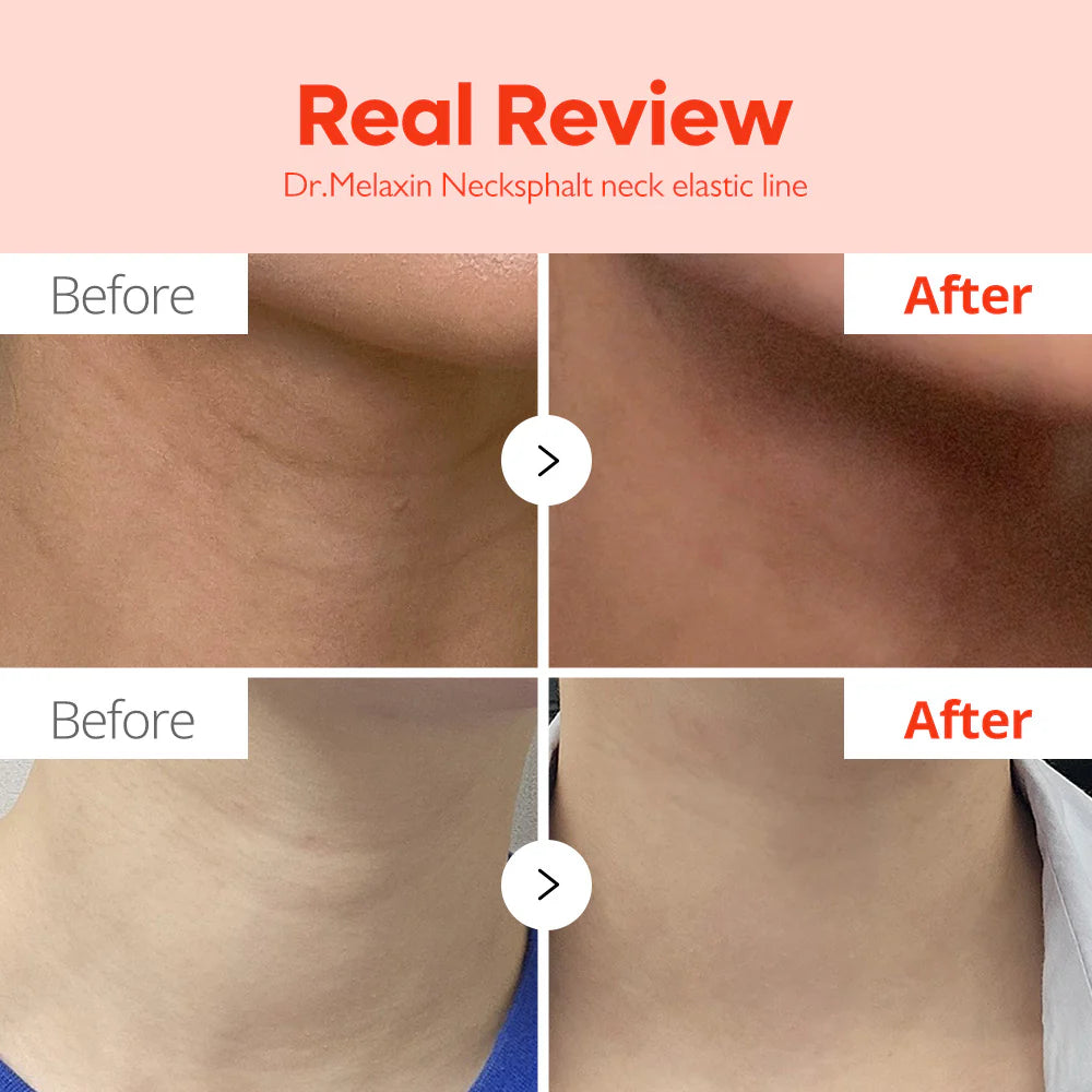 Dr Melaxin Necksphalt ECM Neck Barrier Ampoule 10 x 1.5ml
