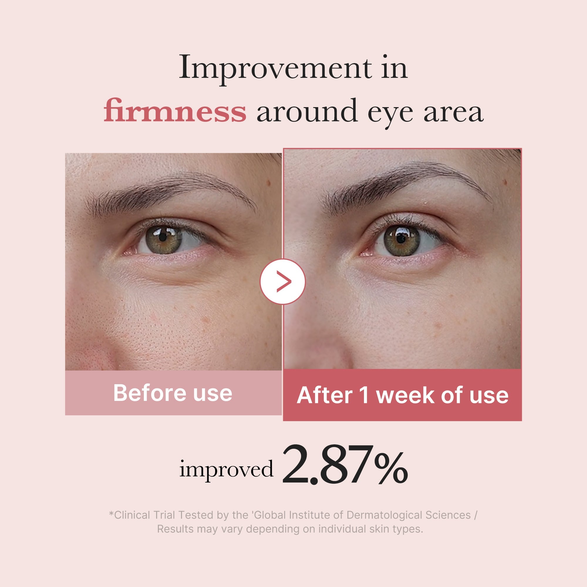 Medicube PDRN Pink Peptide Eye Cream 30ml