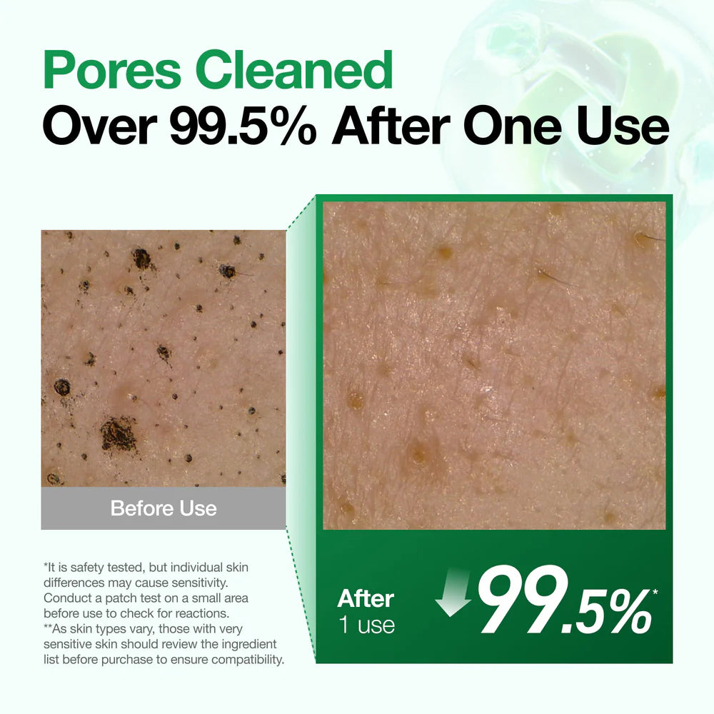 ANUA Pore Cleansing Duo