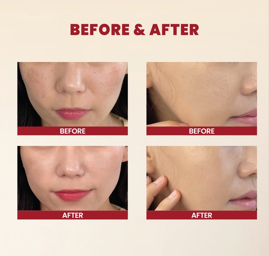 K-Secret Seoul 1988 Cream Snail Mucin 93% + Rice 100ml