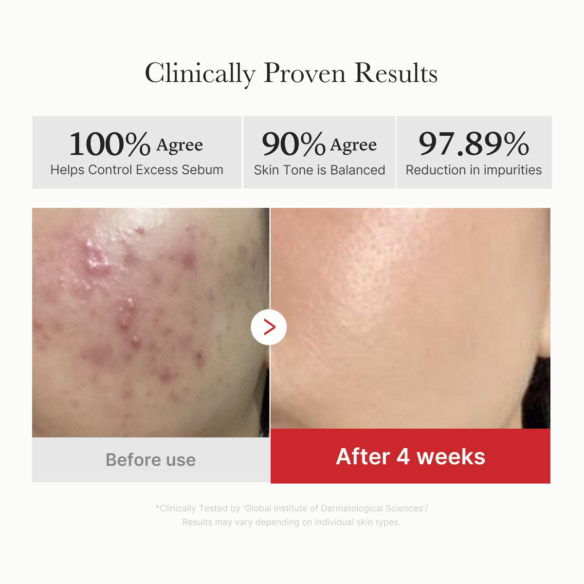Medicube Red Succinic Acid Peeling Pad – brand results claims with before-and-after photos