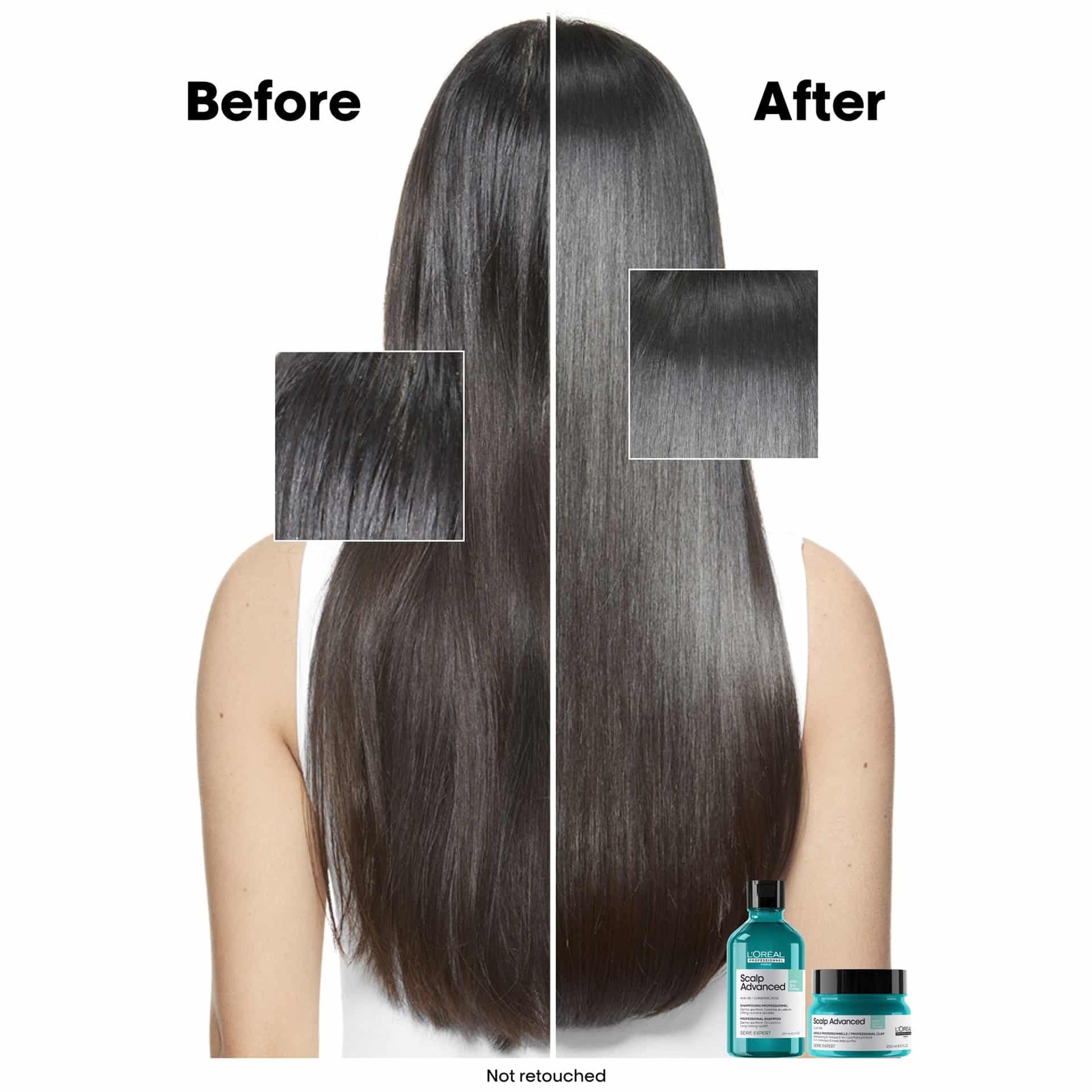 LOréal Scalp Advanced Shampoo for Anti-Oiliness 300ml