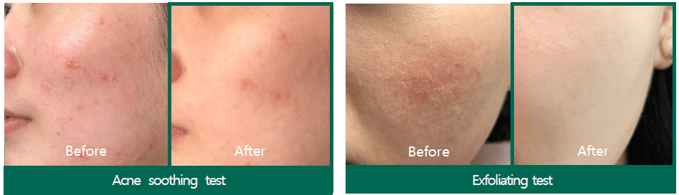SOME BY MI AHA-BHA-PHA Miracle Acne Clear Foam 100ml