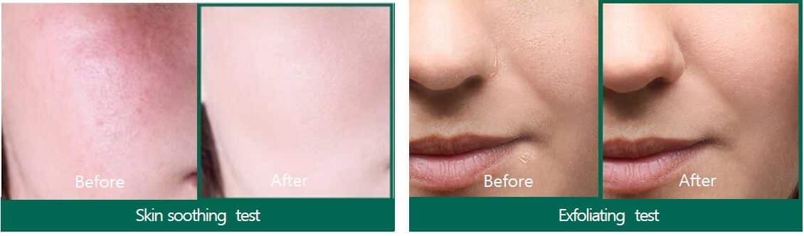 SOME BY MI AHA-BHA-PHA 30 days Miracle Serum 50ml