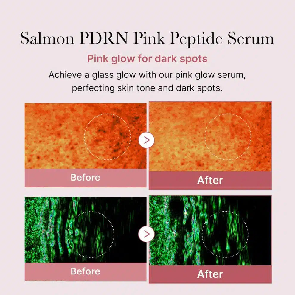 Medicube PDRN Pink Peptide Serum 30ml