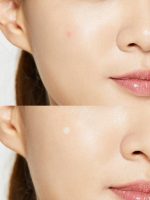 COSRX Acne Pimple Master Patch 24pcs - Image 2