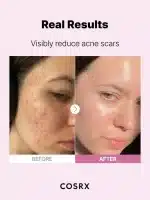 COSRX The Niacinamide 15 Serum 20ml  - Image 8