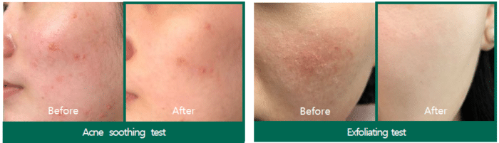 SOME BY MI AHA-BHA-PHA Miracle Acne Clear Foam 100ml - Image 2