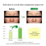 Dr. Althea Gentle Vitamin C Serum 30ml - Image 7