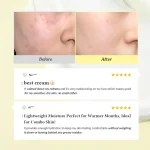 Dr. Althea x SKIN1004 Calming & Pore-Perfecting Duo - Image 3