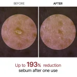 Dr Melaxin Peel Shot Exfoliant White Rice Ampoule 80ml - Image 7